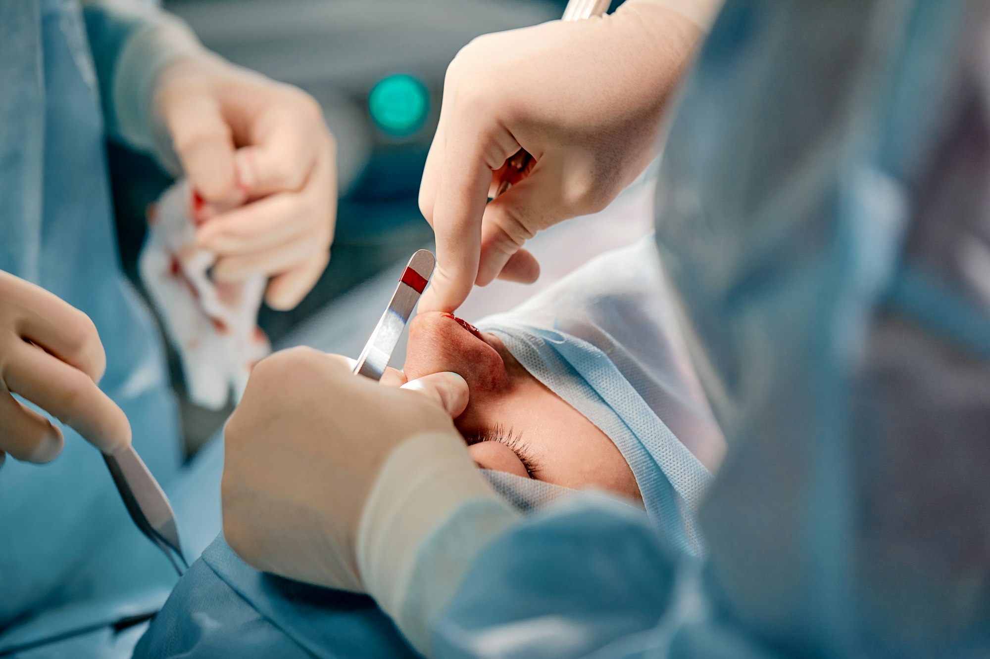 Rhinoplasty men, the surgeon s gloved hands hold the instruments during nose surgery. Doctor in