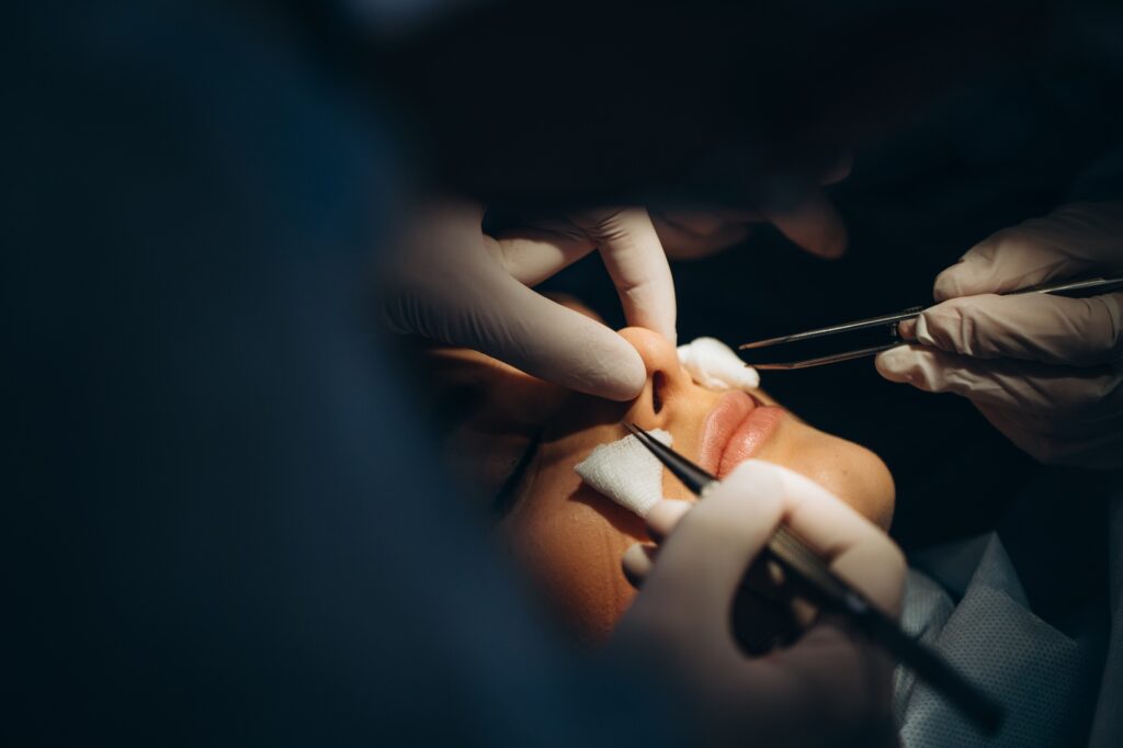 Combien de temps dure une rhinoplastie