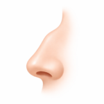 Rhinoplastie Bosse ostéocartilagineuse